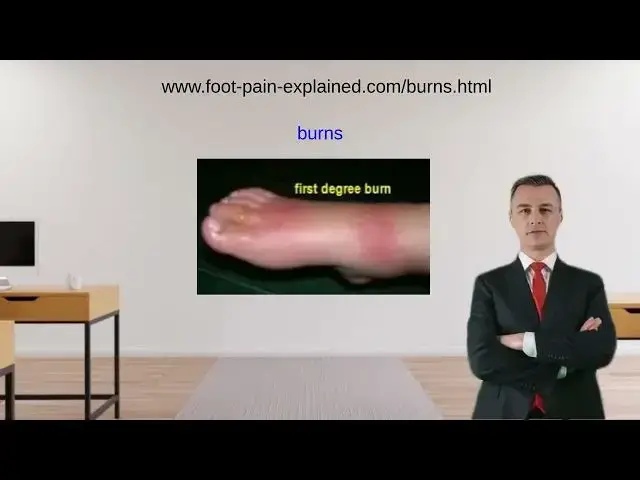 'Video thumbnail for Burns'