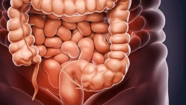 'Video thumbnail for Poop and Colon Cancer: Early Warning Signs, When to Seek Help'