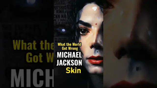 Video thumbnail for The Untold Truth About Michael Jackson’s Skin | Vitiligo Revealed