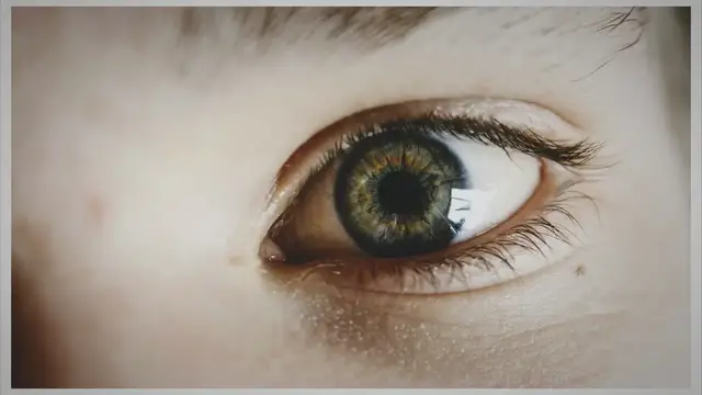 'Video thumbnail for The Complete Guide to Cataracts: Causes, Symptoms, and Prevention'