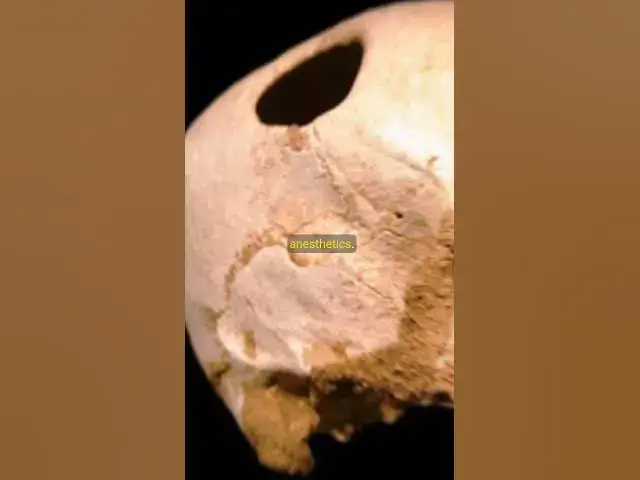 Video thumbnail for TERROR UNDER THE KNIFE Ancient Surgeries You Won’t Believe Happened