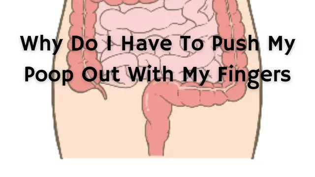 'Video thumbnail for Why Do I Have To Push My Poop Out With My Fingers'