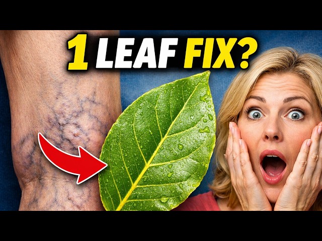 Video thumbnail for Rub Bay Leaf Oil on Your Legs for 7 Days – See What Happens to Varicose Veins