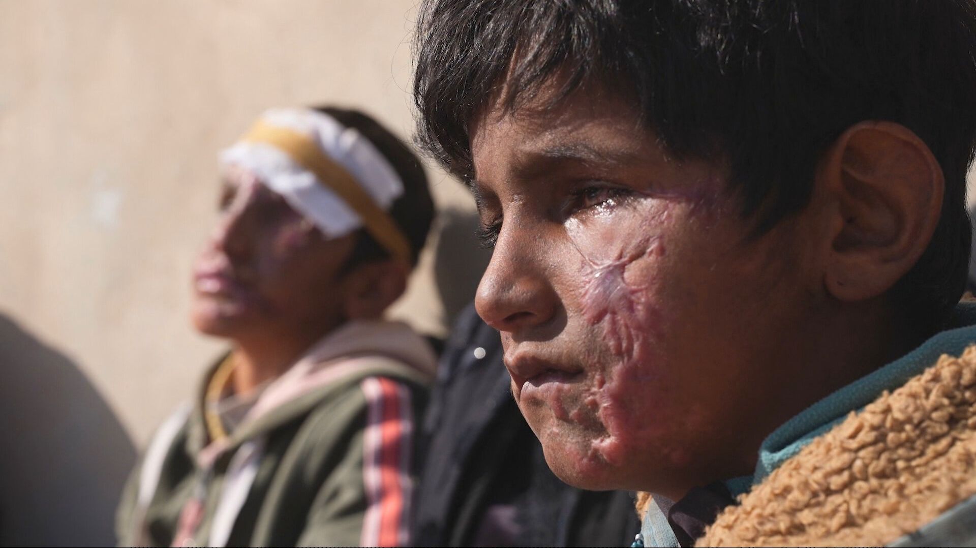 Video thumbnail for Syrians returning home after years of war face the danger of unexploded weapons