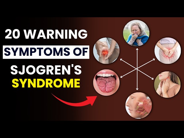 Video thumbnail for 20 Warning Signs of Sjogren's Syndrome You Shouldn’t Ignore | Symptoms of Sjogren's Syndrome