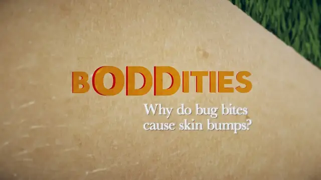 'Video thumbnail for Boddities | Episode 11 | Why do bug bites cause bumps on the skin?'