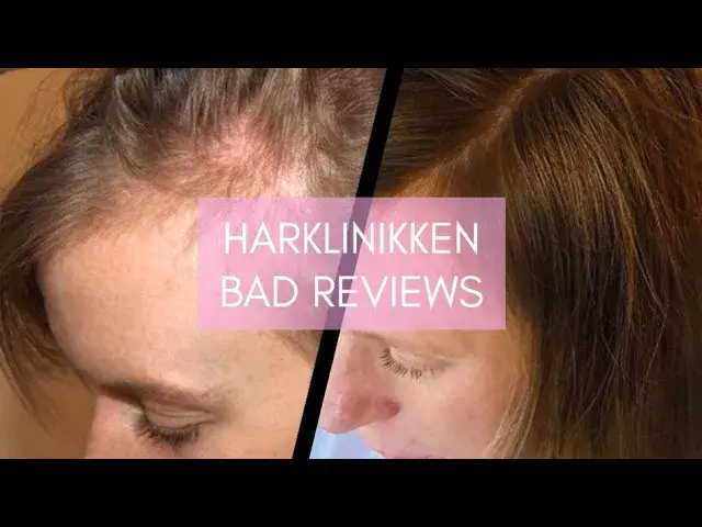 'Video thumbnail for Harklinikken Bad Reviews 2024 | Does Harklinikken Work?'