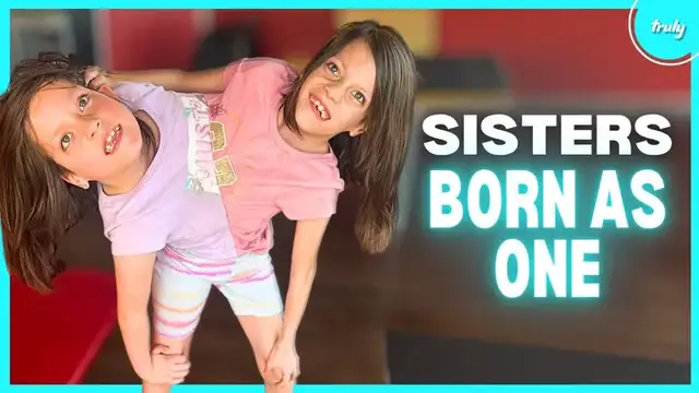 Video thumbnail for Our Conjoined Twins Refuse To Be Separated | BORN DIFFERENT