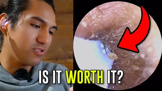 Video thumbnail for What To Expect With This Earwax Tool Camera