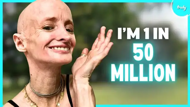 Video thumbnail for I’m The Oldest Living Person With Progeria | BORN DIFFERENT