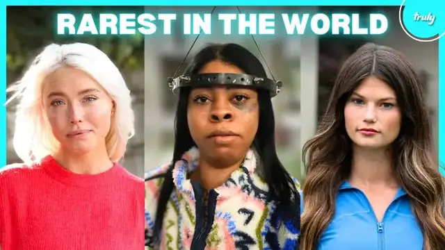 Video thumbnail for 6 Inspiring People Living With The Rarest Conditions | BORN DIFFERENT