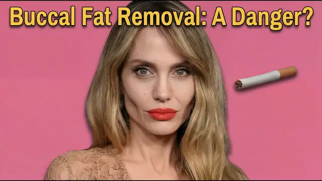 Video thumbnail for They Removed Their Buccal Fat. Now They're Paying to Get It Back