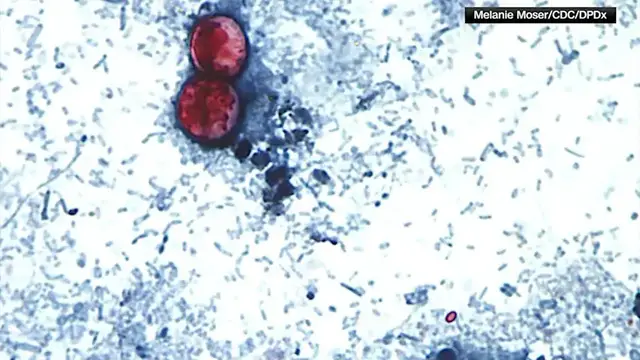 Video thumbnail for The Cyclospora parasite is lurking in your produce. Here’s how to avoid it