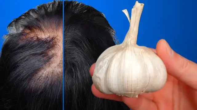 'Video thumbnail for Włosy rosną jak szalone i nie wypadają, to najlepszy środek! Wszyscy za nim szaleją!'