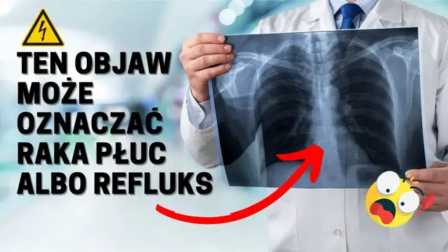 Video thumbnail for Ten objaw może oznaczać raka płuc albo refluks!