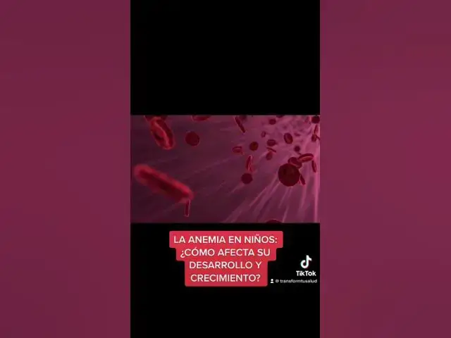 Video thumbnail for LA ANEMIA EN NIÑOS: ¿CÓMO AFECTA SU DESARROLLO Y CRECIMIENTO?