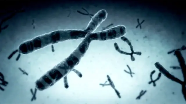 Video thumbnail for Zombie Cells and Aging: What They Do to Our Bodies