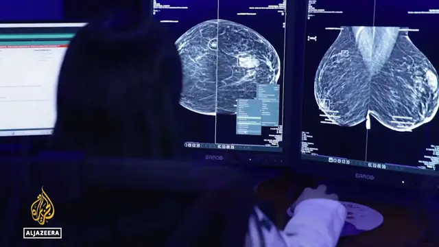 Video thumbnail for Bridging Mexico's public health gap: AI strengthening early breast cancer detection