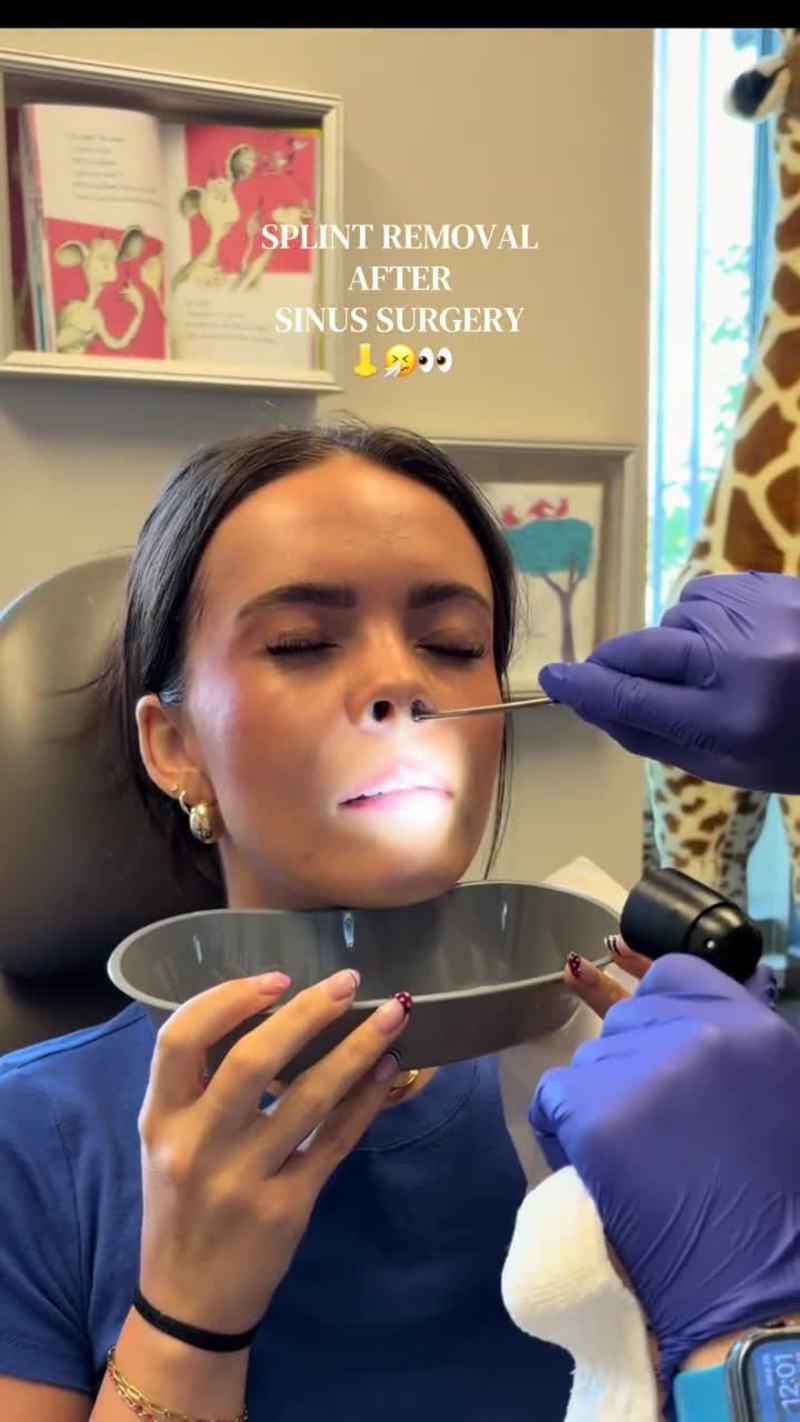 Video thumbnail for Nasal Splint Removal after Sinus Surgery in Clinic