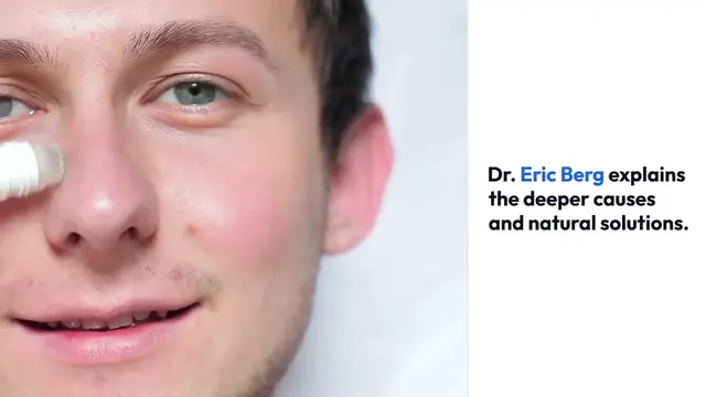 Video thumbnail for Acne Causes and Natural Remedies