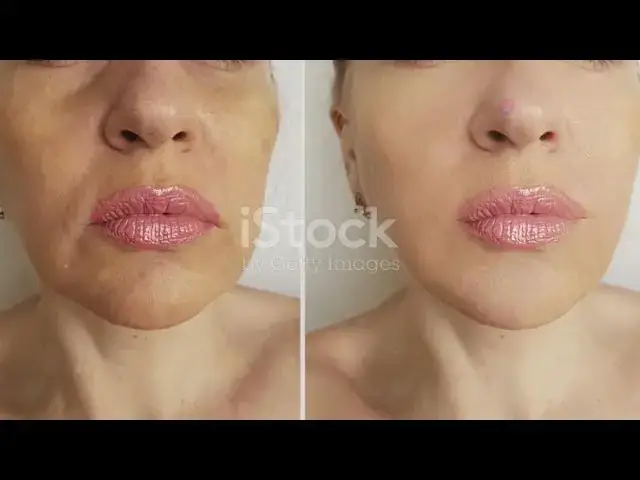 'Video thumbnail for THE BEST LED BEAUTY TECH ON THE MARKET | HealthBeautyLondon.com'