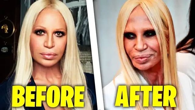 'Video thumbnail for Worst Celebrity Plastic Surgeries'