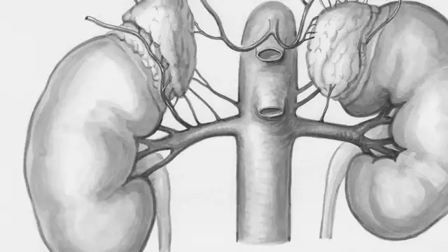 Video thumbnail for Chanca Piedra: Natural Support for Kidney, Liver, and Digestive Health