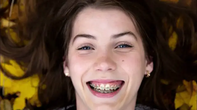 'Video thumbnail for Can I eat cinnamon toast crunch with braces'