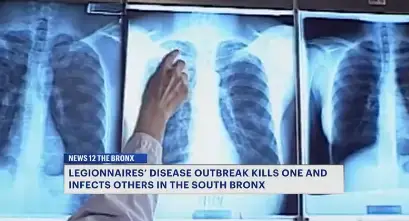 Video thumbnail for Bronx Legionnaires' disease outbreak grows to 10 cases; 1 dead
