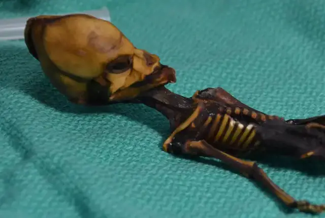 'Video thumbnail for This Weird Skeleton Is Definitely Not An Alien'