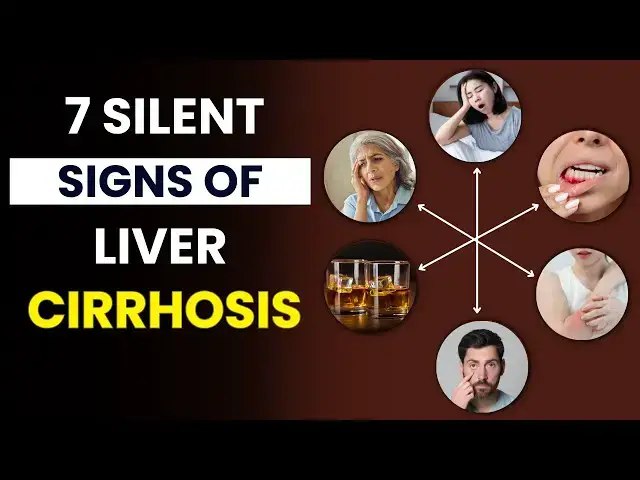 'Video thumbnail for 7 Silent Signs of Liver Cirrhosis You Should NEVER Ignore! | Symptoms of Liver Cirrhosis'