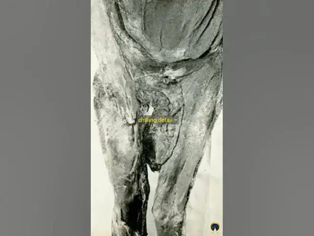 Video thumbnail for Teenage Mummy Found with Fetus Trapped in Her Pelvis Shows Harsh Reality of Childbirth