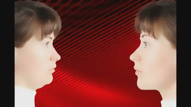 'Video thumbnail for Transform Your Side Profile: The Power of Orthodontics and Facial Aesthetics'
