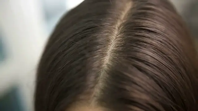 Video thumbnail for The Ultimate Guide to Effectively Remove Dandruff