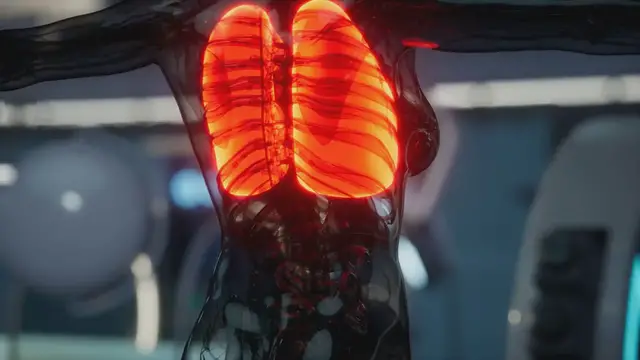 Video thumbnail for AstraZeneca shares fall 5% on disappointing lung cancer drug trial results