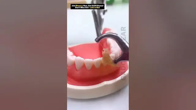 Video thumbnail for Product Link in Bio ✅ | Dental Hygiene Tool Kit | #viral #tools