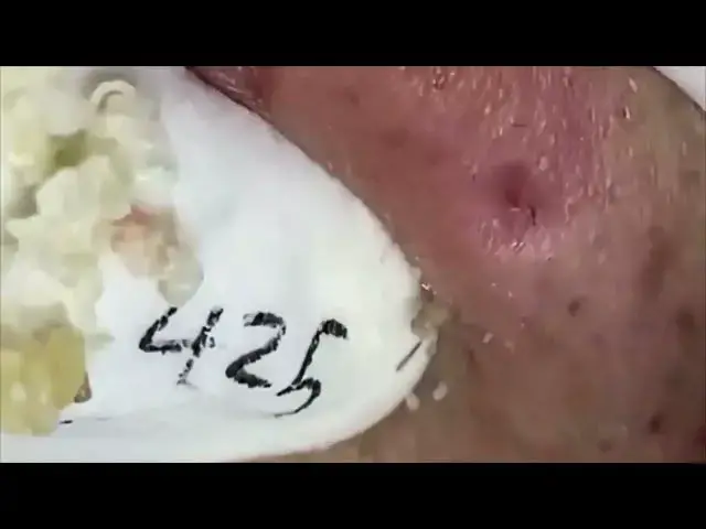 Video thumbnail for 𝙁𝙖𝙘𝙞𝙖𝙡 𝘾𝙡𝙚𝙖𝙣𝙨𝙞𝙣𝙜 Relax Every Day SacDepSpa Hours #100001