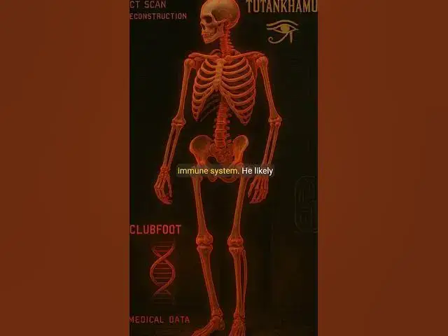 Video thumbnail for KING TUT’S BLOODLINE WAS A MESS