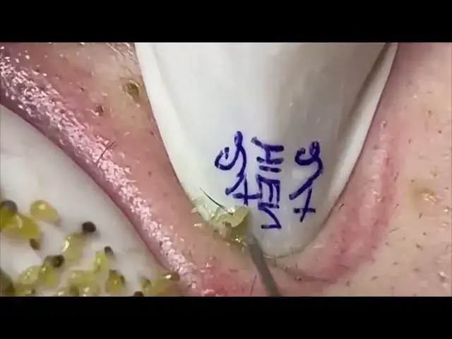 Video thumbnail for 𝙁𝙖𝙘𝙞𝙖𝙡 𝘾𝙡𝙚𝙖𝙣𝙨𝙞𝙣𝙜 Relax Every Day SacDepSpa Hours #100003