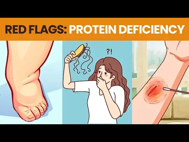 Video thumbnail for Protein Deficiency Symptoms - You Need to Know | 8 Signs of Low Protein