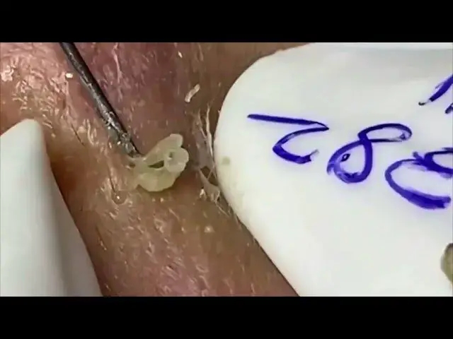 Video thumbnail for 𝙁𝙖𝙘𝙞𝙖𝙡 𝘾𝙡𝙚𝙖𝙣𝙨𝙞𝙣𝙜 Relax Every Day SacDepSpa Hours #100000