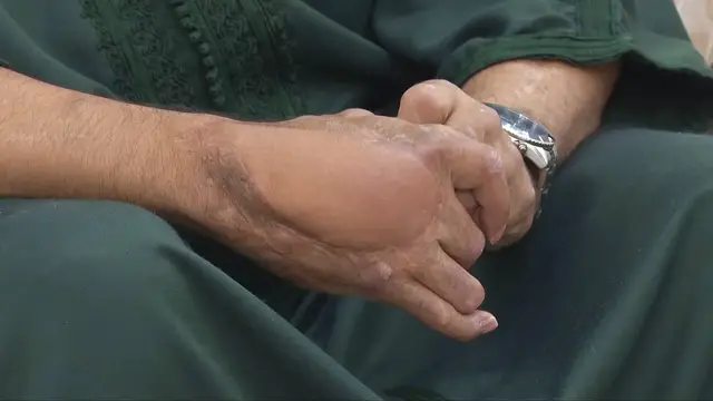 'Video thumbnail for Blinded in Haftar’s war, Libyan deminer Mahmoud seeks justice as mine danger persists'