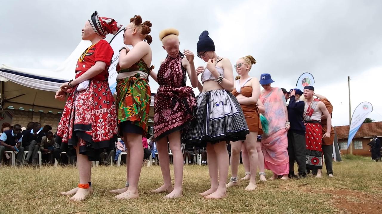 Video thumbnail for Kenya: Kenya's Thika hosts public events for International Albinism Awareness Day.