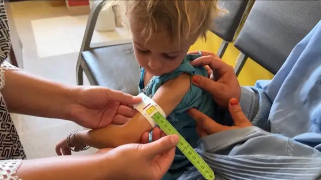 Video thumbnail for Deadliest form of child malnutrition has reached critical levels in Afghanistan