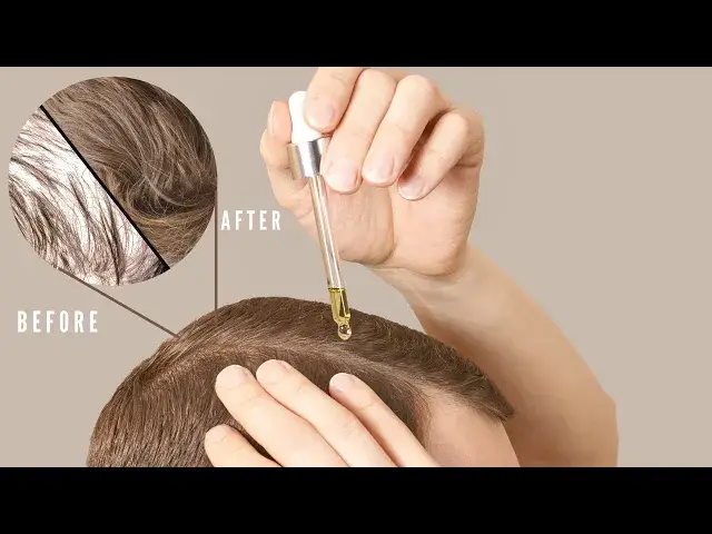 'Video thumbnail for DIY DHT BLOCKER HAIR OIL, Best Hair Oil to Reverse Hair Loss | HealthBeautyLondon.com #beauty'