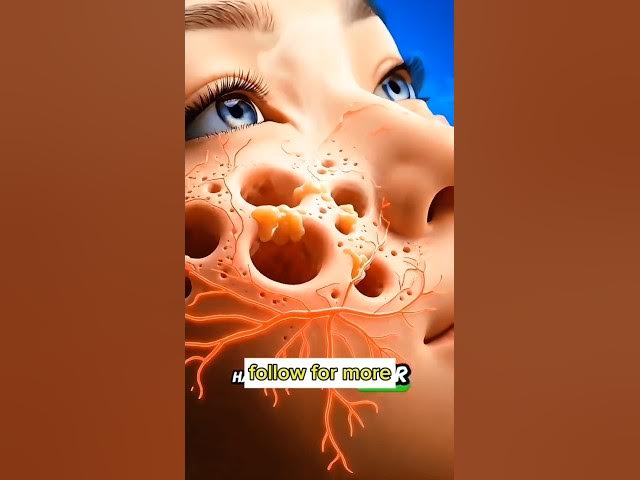 Video thumbnail for agar aap galti se Chingam nikal Jaaye to kya hoga