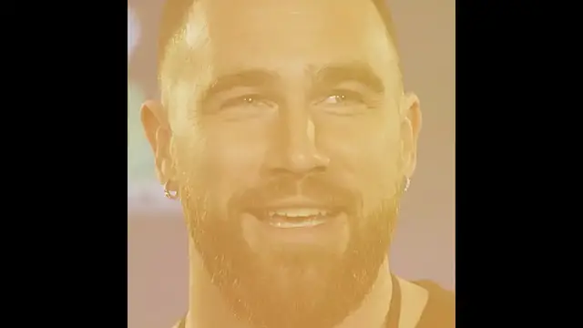 Video thumbnail for Top 5 Botched Celebrities Who Became Unrecognizable