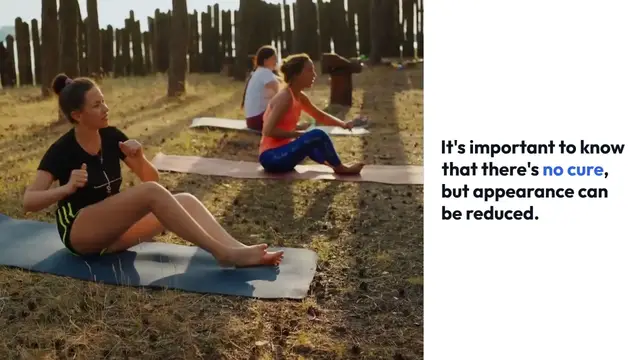 Video thumbnail for The Best Workout for Cellulite