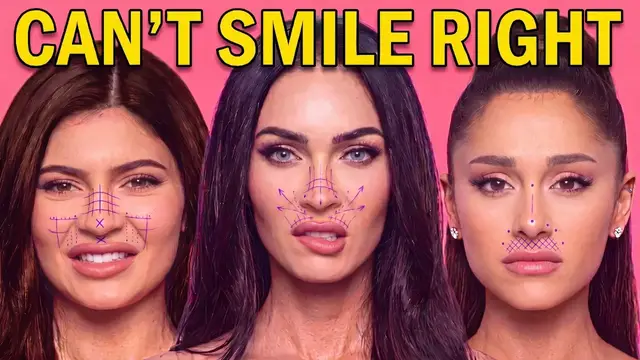 Video thumbnail for They Lifted Their Lips For Youth Now They Can't Smile Right