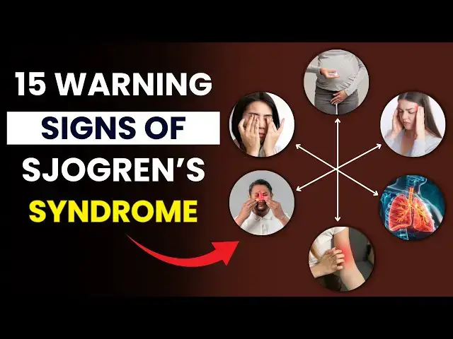Video thumbnail for 15 Silent Symptoms of Sjogren's Syndrome You Shouldn’t Ignore | Early Signs of Sjogren's Syndrome